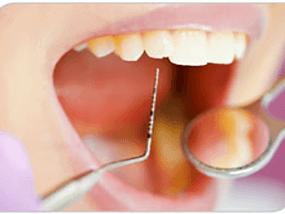 periodoncia